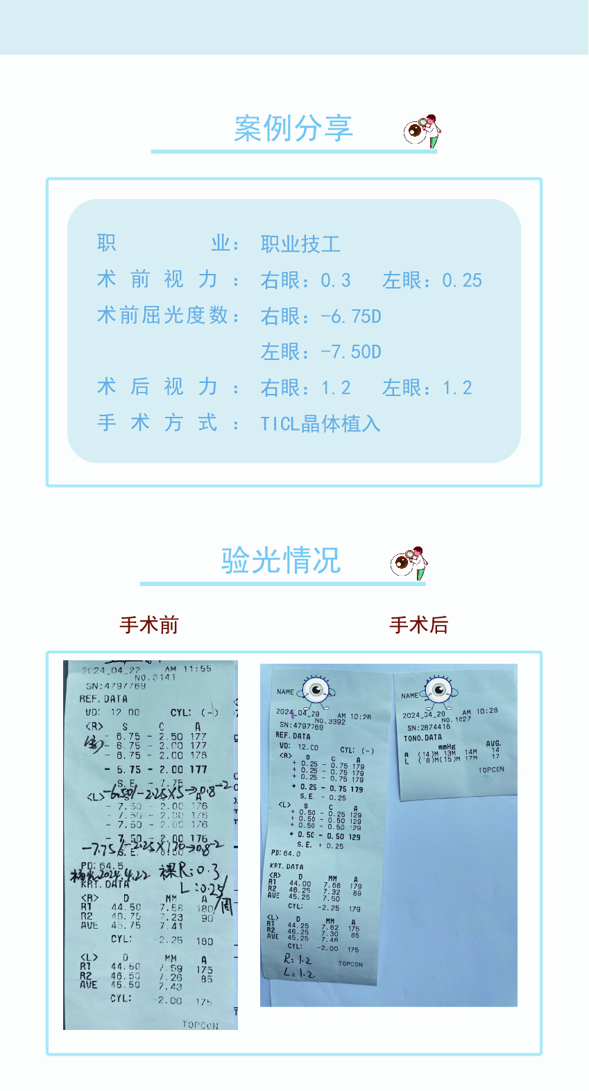 TICL晶体植入