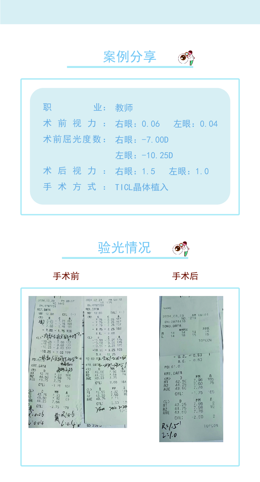 TICL晶体植入-1